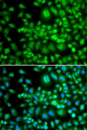 SETD5 Antibody