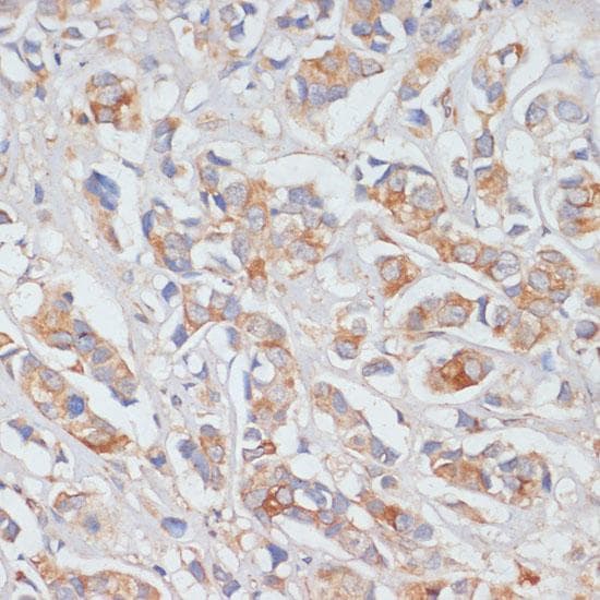 Polyclonal Rabbit anti-Human DLL1 Antibody (IHC)