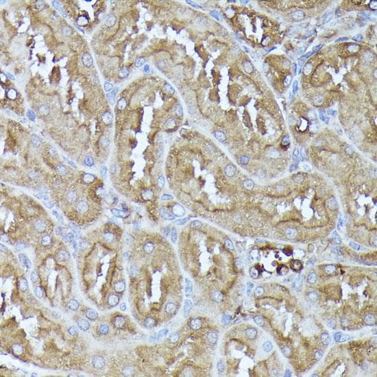 Polyclonal Rabbit anti-Human DLAT / PDC-E2 Antibody (IHC, IF, WB)