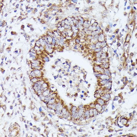 Polyclonal Rabbit anti-Human DLAT / PDC-E2 Antibody (IHC, IF, WB)