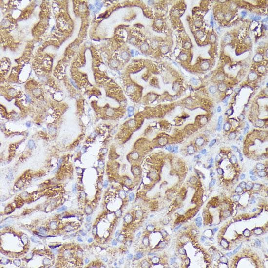 Polyclonal Rabbit anti-Human DLAT / PDC-E2 Antibody (IHC, IF, WB)