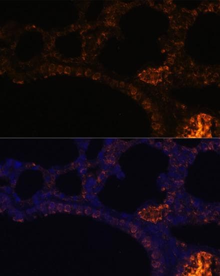Polyclonal Rabbit anti-Human Mucin 2 / MUC2 Antibody (IF)