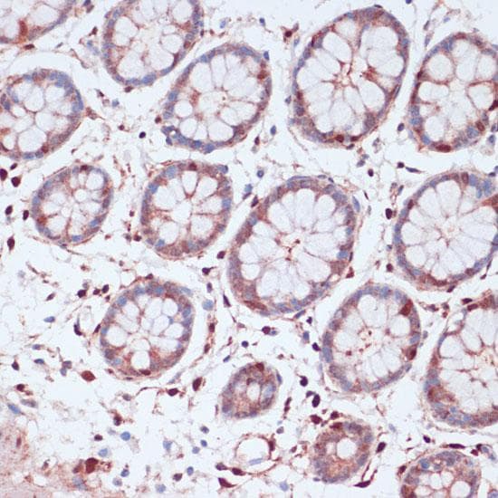 Polyclonal Rabbit anti-Human S100A5 Antibody (IHC)