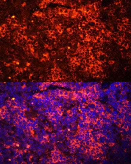 Polyclonal Rabbit anti-Human TLR8 Antibody (IF, WB)