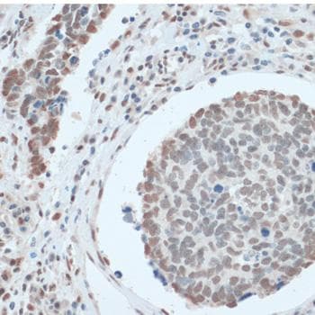 ZNF433 Antibody