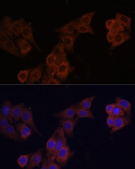 Polyclonal Rabbit anti-Human DCN / Decorin Antibody (IF)