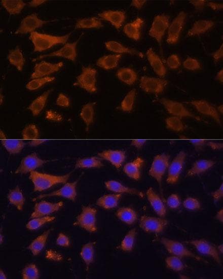Polyclonal Rabbit anti-Human DCN / Decorin Antibody (IF)