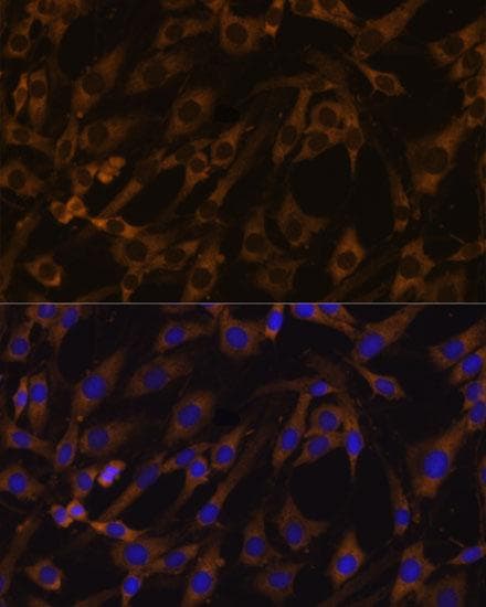 Polyclonal Rabbit anti-Human EIF5B / IF2 Antibody (IF, WB)