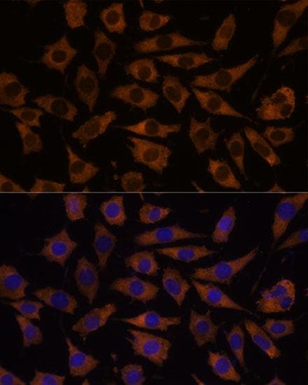 Polyclonal Rabbit anti-Human EIF5B / IF2 Antibody (IF, WB)