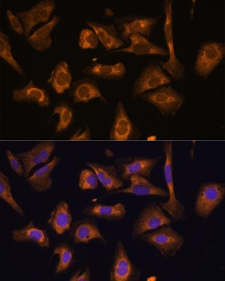 Polyclonal Rabbit anti-Human EIF5B / IF2 Antibody (IF, WB)