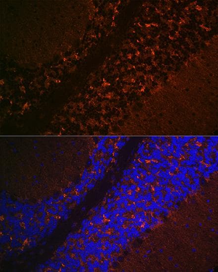 SLC17A6 / VGLUT2 Antibody