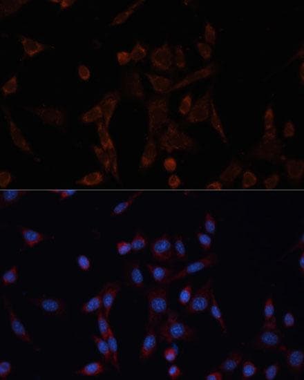 Polyclonal Rabbit anti-Human CANX / Calnexin Antibody (IF)