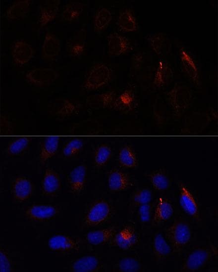 Polyclonal Rabbit anti-Human SLC9A1BP / CHP Antibody (IF)