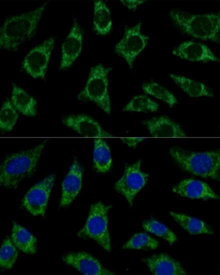 ETFB Antibody