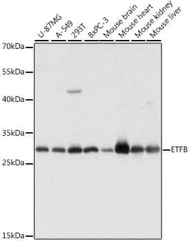 ETFB Antibody