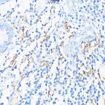 HLA-DRB3 Antibody