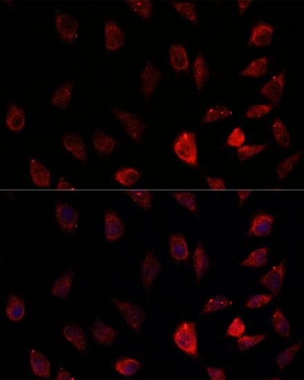 Polyclonal Rabbit anti-Human P450SCC / CYP11A1 Antibody (IHC, IF)