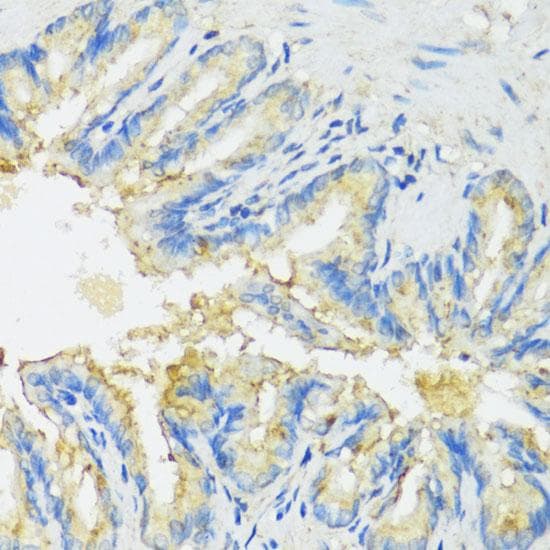 Polyclonal Rabbit anti-Human P450SCC / CYP11A1 Antibody (IHC, IF)