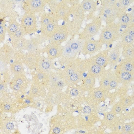 Polyclonal Rabbit anti-Human P450SCC / CYP11A1 Antibody (IHC, IF)