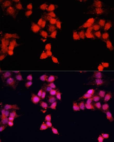 Polyclonal Rabbit anti-Human ENO3 / Enolase 3 Antibody (IF)