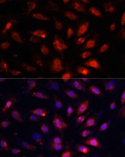 Polyclonal Rabbit anti-Human ENO3 / Enolase 3 Antibody (IF)