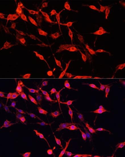 Polyclonal Rabbit anti-Human ENO3 / Enolase 3 Antibody (IF)