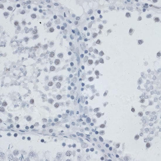 MSH6 Antibody
