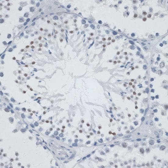 MSH6 Antibody