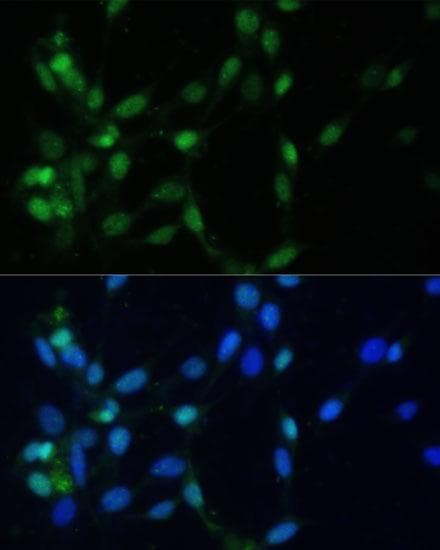 Polyclonal Rabbit anti-Human MAD2L1 / MAD2 Antibody (IHC, IF)