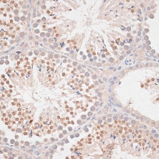 Polyclonal Rabbit anti-Human MAD2L1 / MAD2 Antibody (IHC, IF)