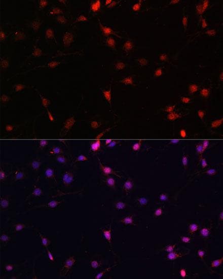 Polyclonal Rabbit anti-Human VEGFD Antibody (IF, WB)