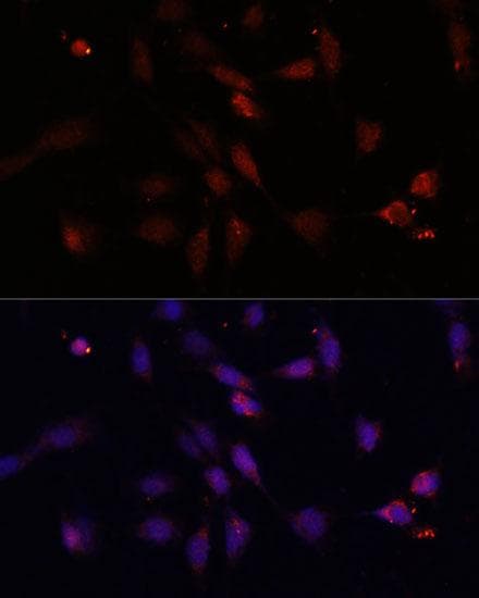 Polyclonal Rabbit anti-Human VEGFD Antibody (IF, WB)