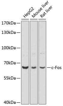 Polyclonal Rabbit anti-Human VEGFD Antibody (IF, WB)
