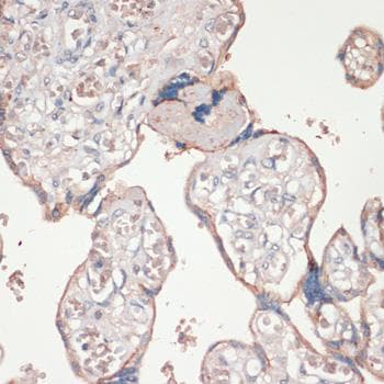Polyclonal Rabbit anti-Human PYCARD / ASC / TMS1 Antibody (IHC, IF)