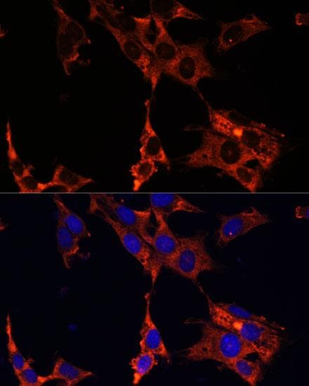 Polyclonal Rabbit anti-Human ERK1 + ERK2 Antibody (IHC, IF)
