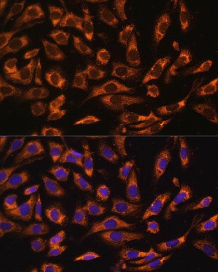 Polyclonal Rabbit anti-Human ERK1 + ERK2 Antibody (IHC, IF)