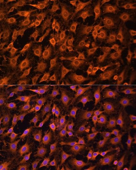 Polyclonal Rabbit anti-Human ERK1 + ERK2 Antibody (IHC, IF)