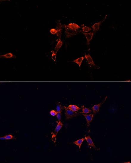 Polyclonal Rabbit anti-Human ERK1 + ERK2 Antibody (IHC, IF)