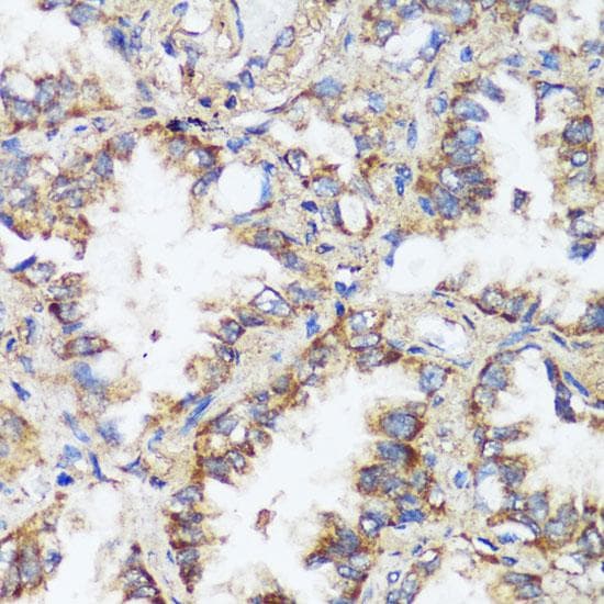 Polyclonal Rabbit anti-Human ERK1 + ERK2 Antibody (IHC, IF)