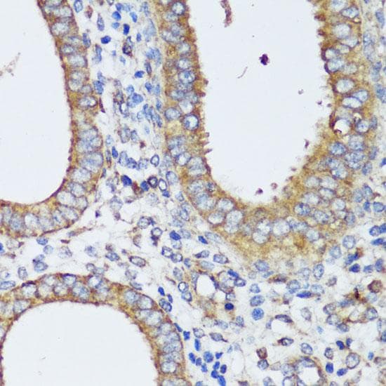 Polyclonal Rabbit anti-Human ERK1 + ERK2 Antibody (IHC, IF)