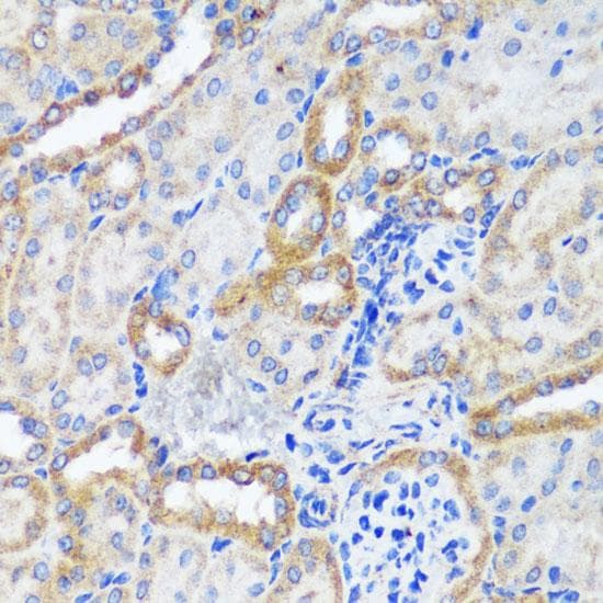 Polyclonal Rabbit anti-Human ERK1 + ERK2 Antibody (IHC, IF)