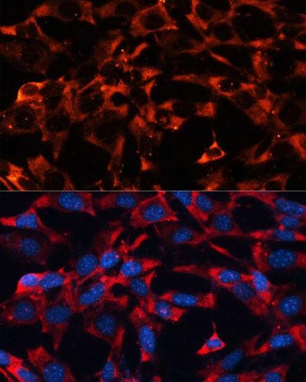 Polyclonal Rabbit anti-Human ERK1 + ERK2 Antibody (IF)