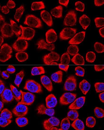 Polyclonal Rabbit anti-Human ERK1 + ERK2 Antibody (IF)