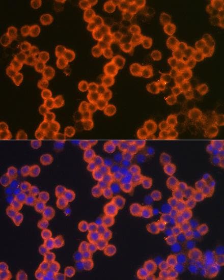 Polyclonal Rabbit anti-Human CD38 Antibody (IF)