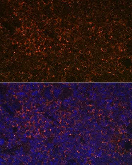 Polyclonal Rabbit anti-Human CD38 Antibody (IF)