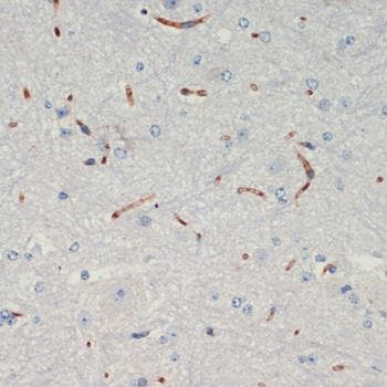 Polyclonal Rabbit anti-Human THBS1 / Thrombospondin-1 Antibody (IHC)