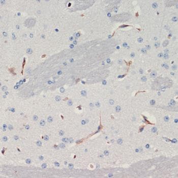 Polyclonal Rabbit anti-Human THBS1 / Thrombospondin-1 Antibody (IHC)