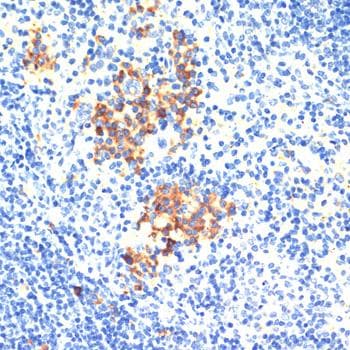 Polyclonal Rabbit anti-Human THBS1 / Thrombospondin-1 Antibody (IHC)