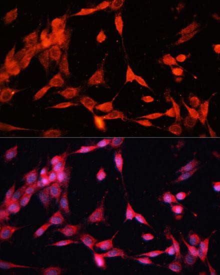 Polyclonal Rabbit anti-Human TRAF6 Antibody (IF)