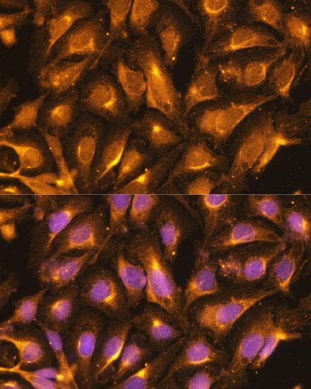 Polyclonal Rabbit anti-Human TRAF6 Antibody (IF)